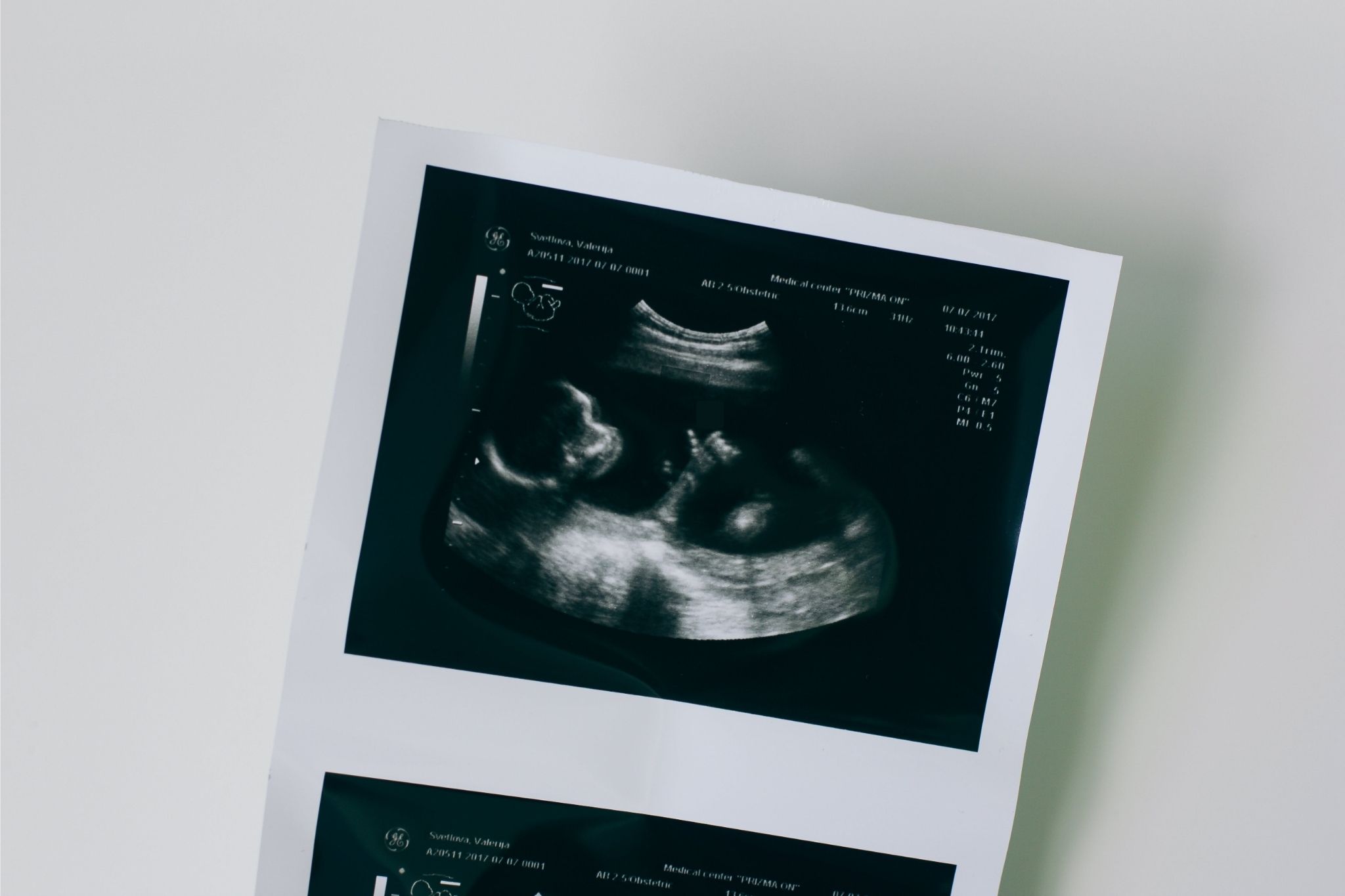 pregnancy discrimination lawyer glendale